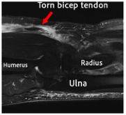 MRI Img
